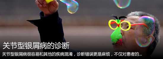 关节型银屑病如何进行诊断