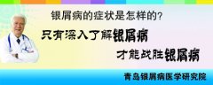 银屑病的症状是怎样的
