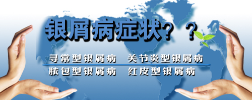 银屑病的一般症状是什么
