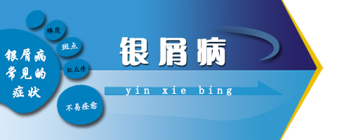 银屑病常见症状是什么