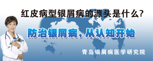 红皮病型银屑病的源头是什么