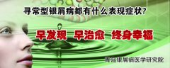寻常型银屑病都有什么表现症状