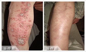 感谢我院的治疗
